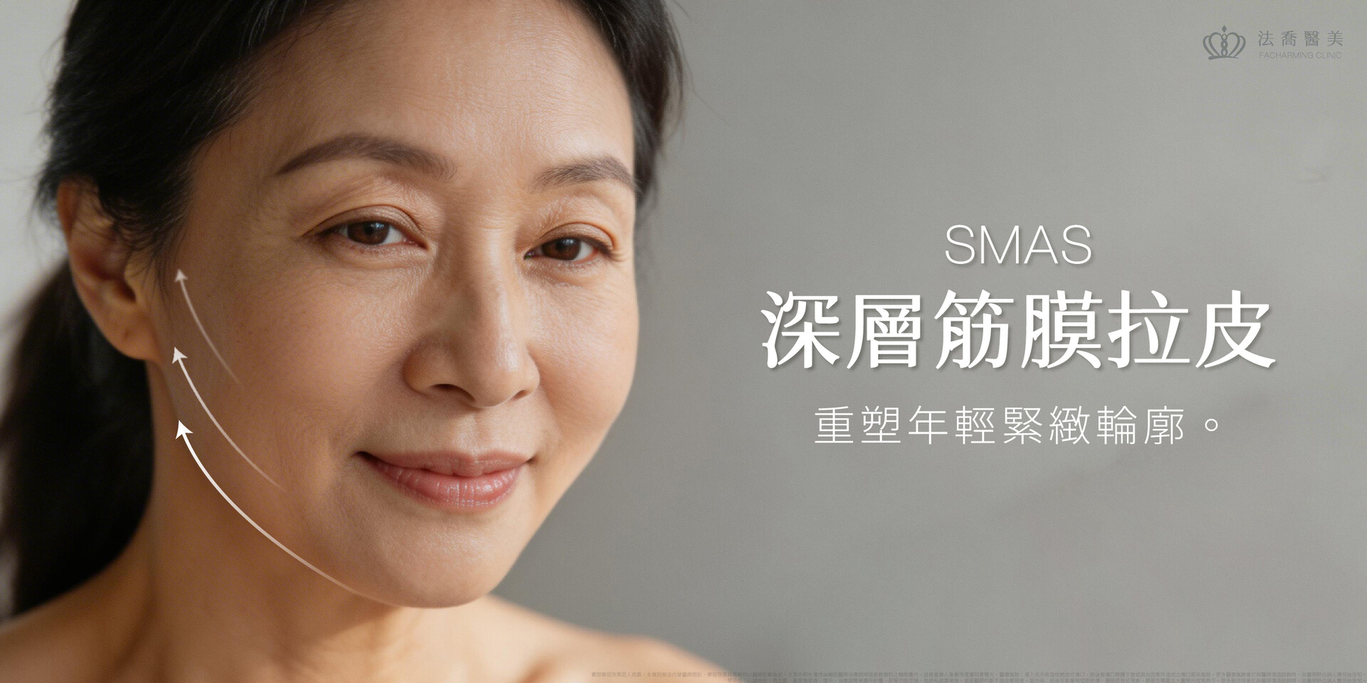 SMAS深層筋膜拉皮