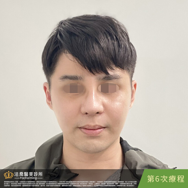 高壓氧第七次記錄