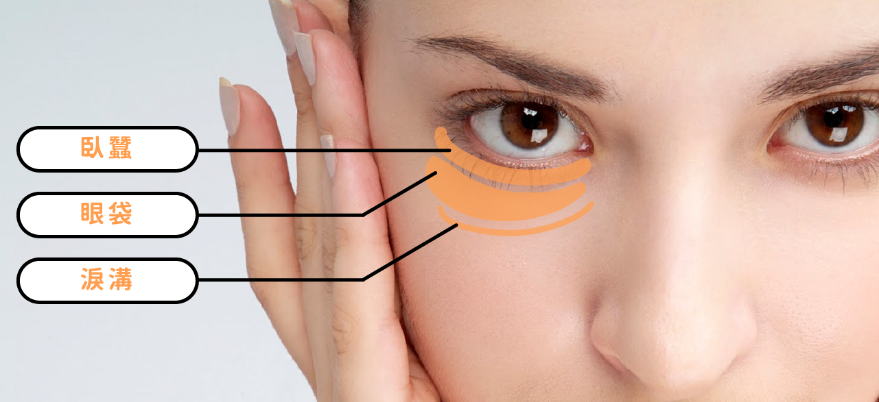如何分辨臥蠶 眼袋 淚溝