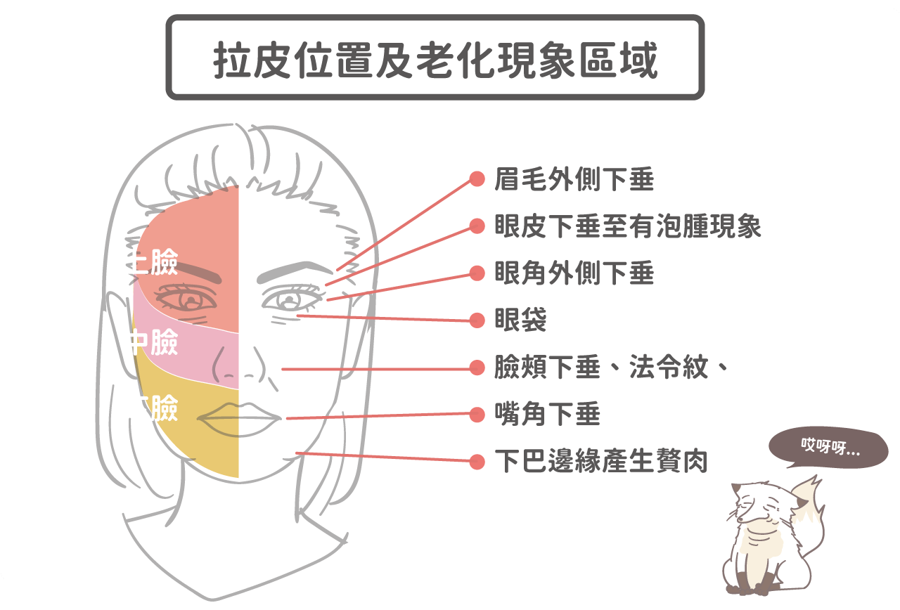 臉部拉皮位置及適應症