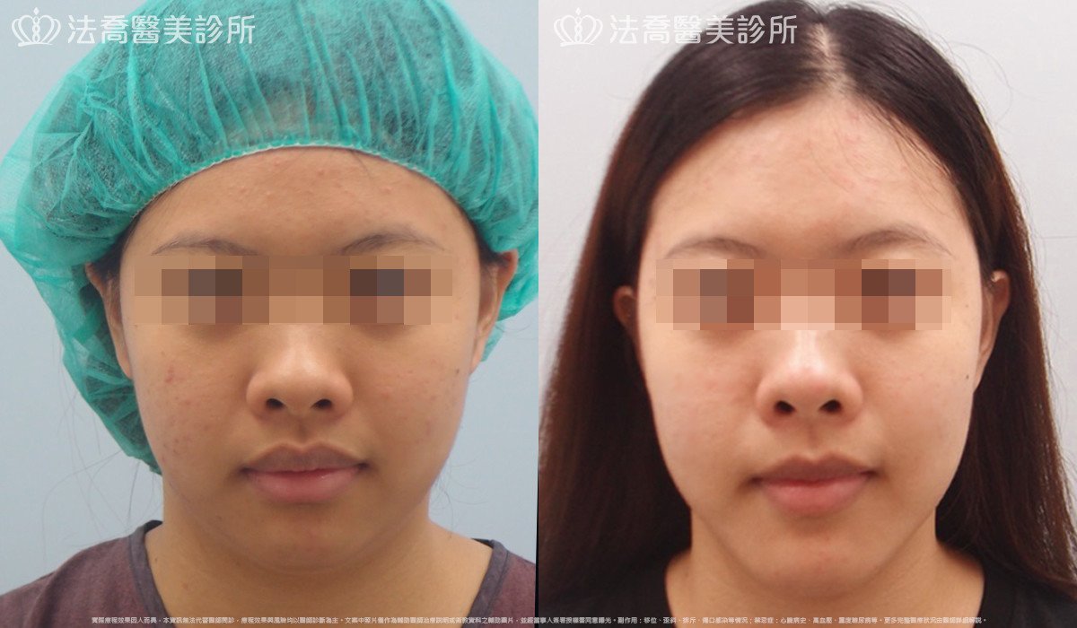 法喬醫美診所 邱浚彥醫師