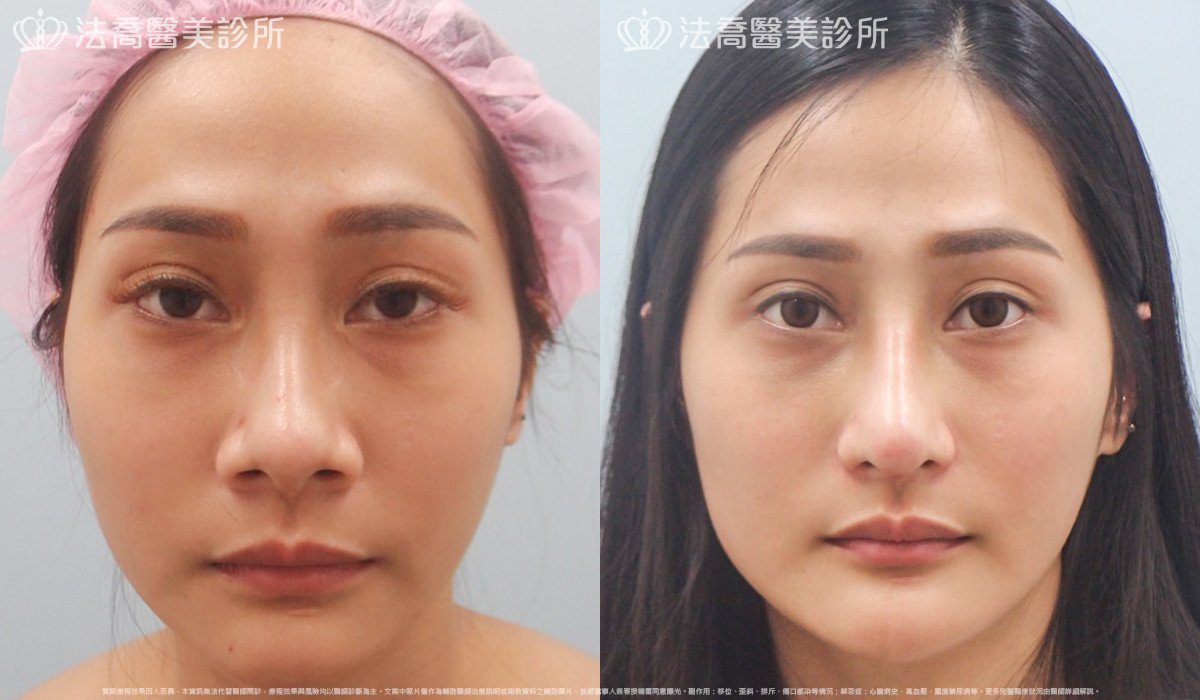 法喬醫美診所 邱浚彥醫師