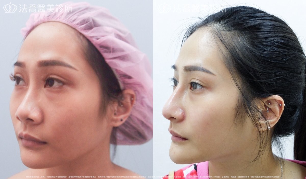 法喬醫美診所 邱浚彥醫師