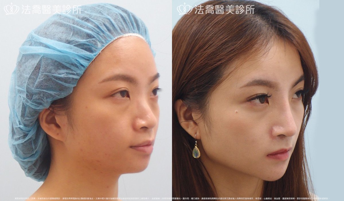 法喬醫美診所 邱浚彥醫師