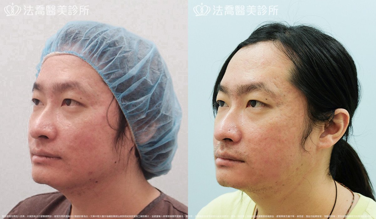 法喬醫美診所 邱浚彥醫師