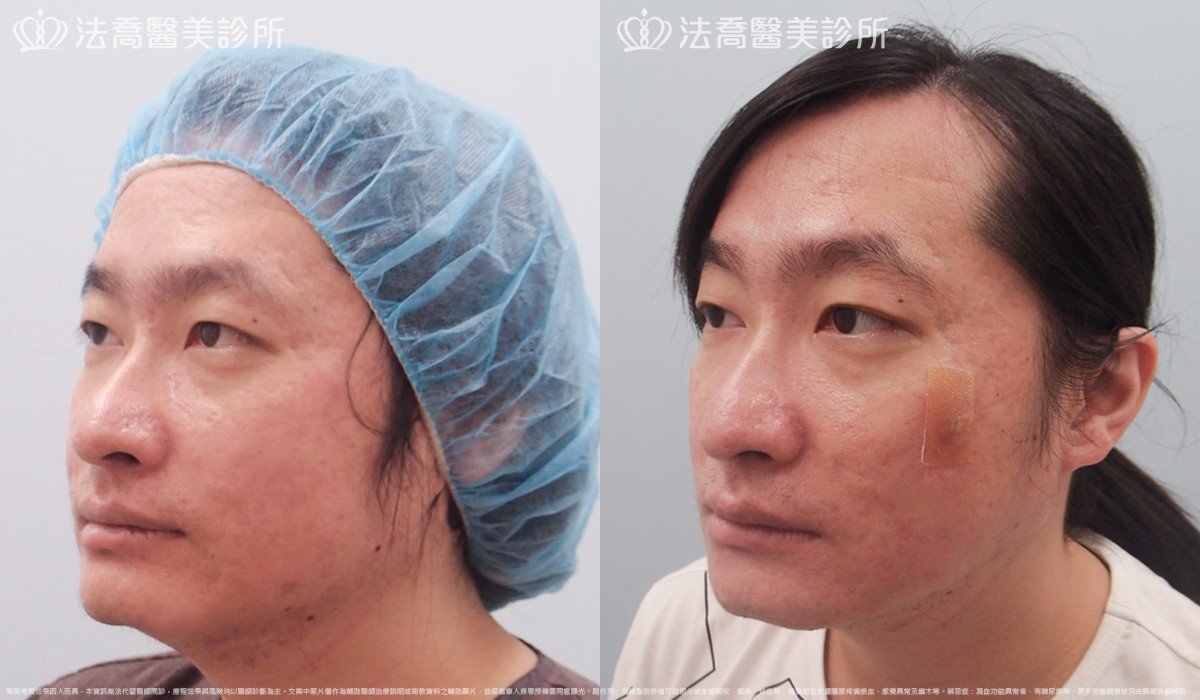 法喬醫美診所 邱浚彥醫師