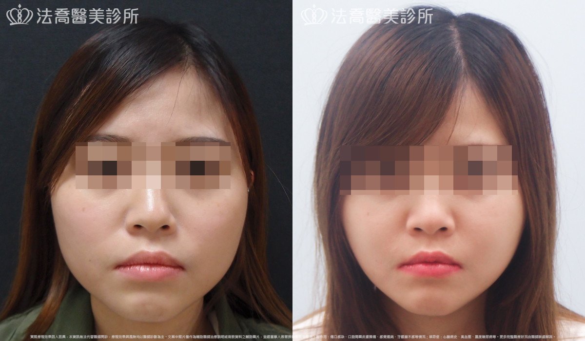 法喬醫美診所 邱浚彥醫師