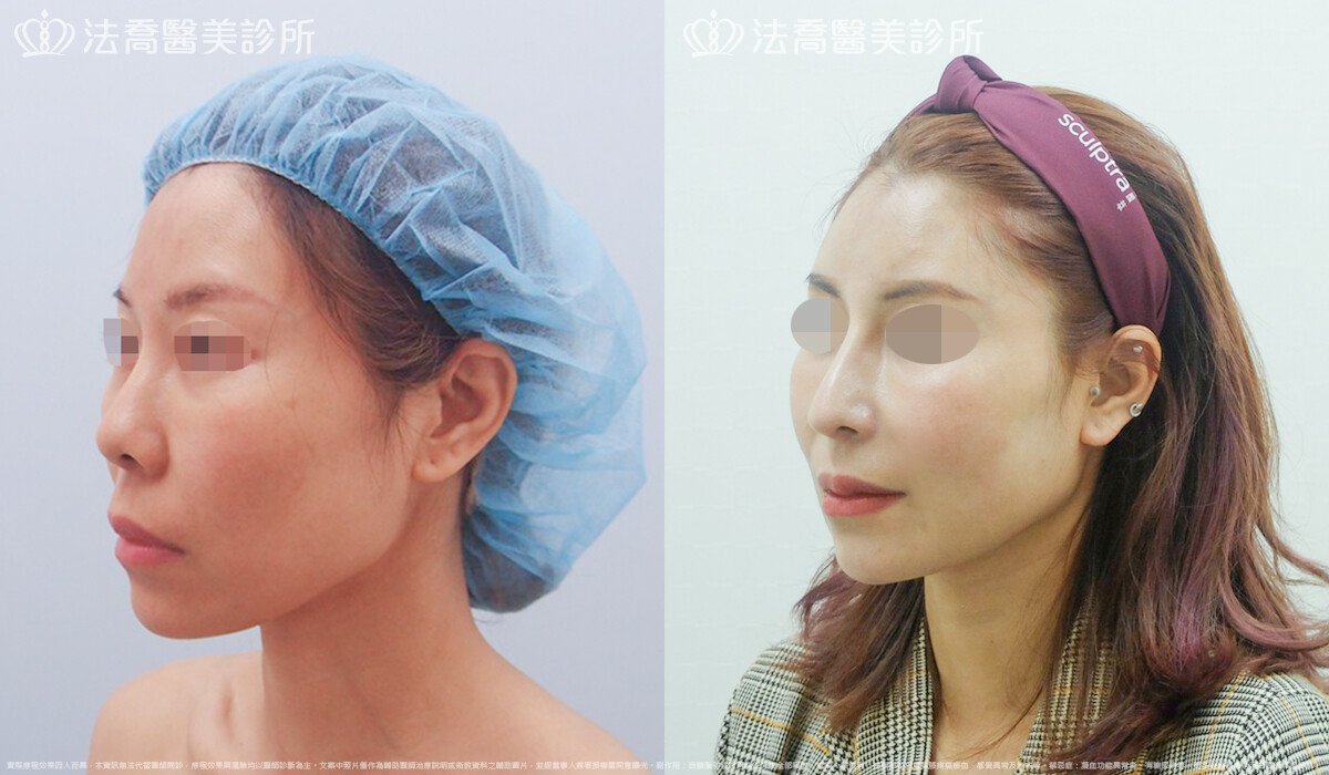 法喬醫美診所 邱浚彥醫師