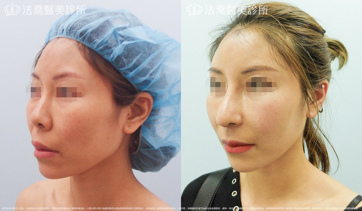 法喬醫美診所 邱浚彥醫師