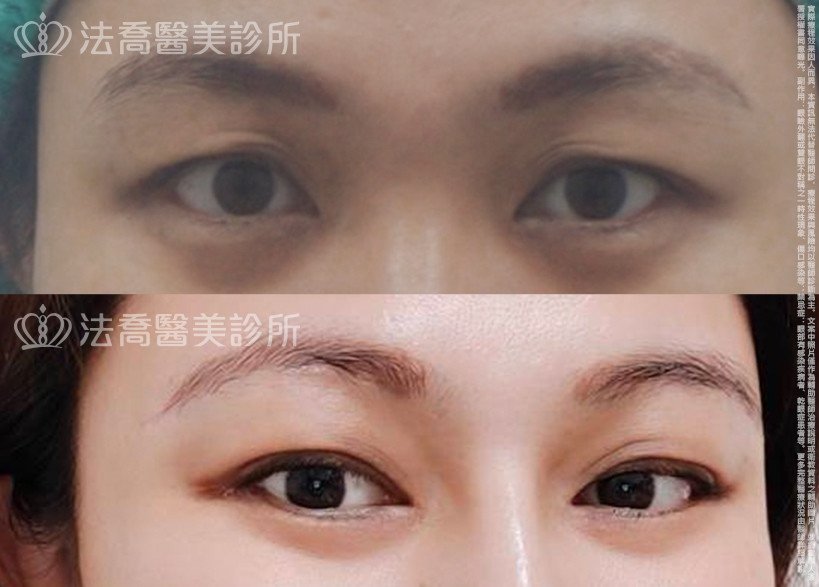 法喬醫美診所 邱浚彥醫師