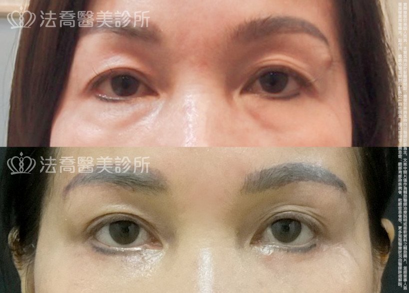 法喬醫美診所 邱浚彥醫師