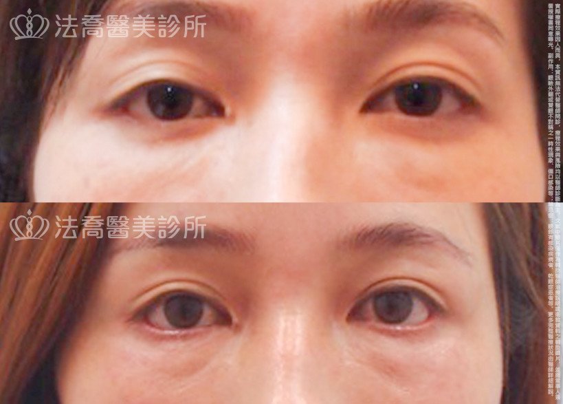 法喬醫美診所 邱浚彥醫師