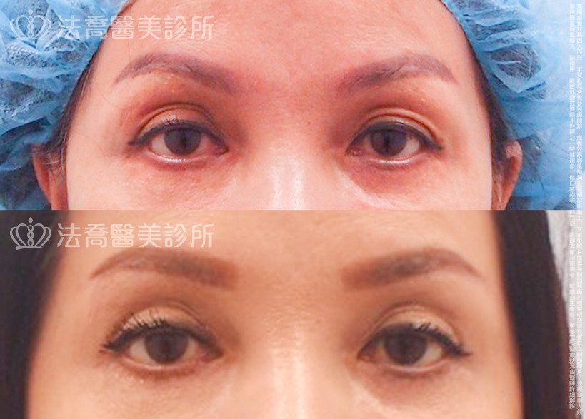 法喬醫美診所 邱浚彥醫師