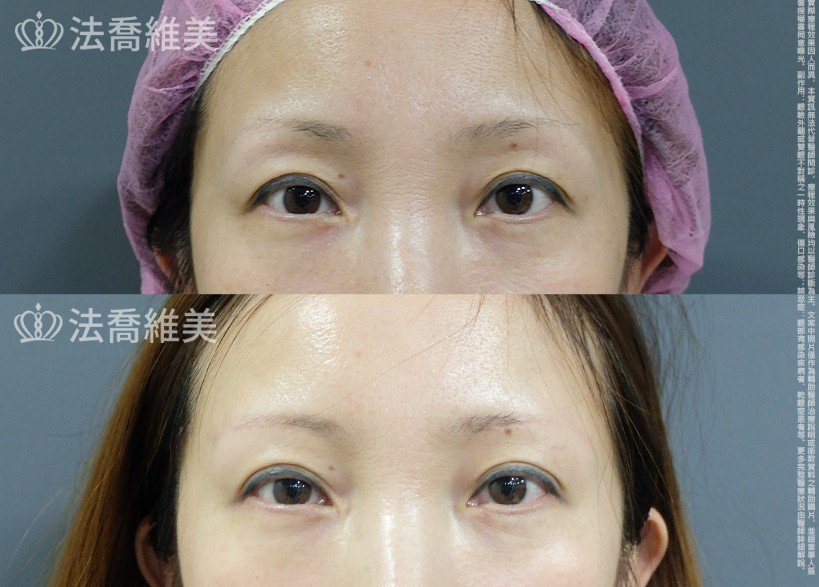 法喬維美醫美診所