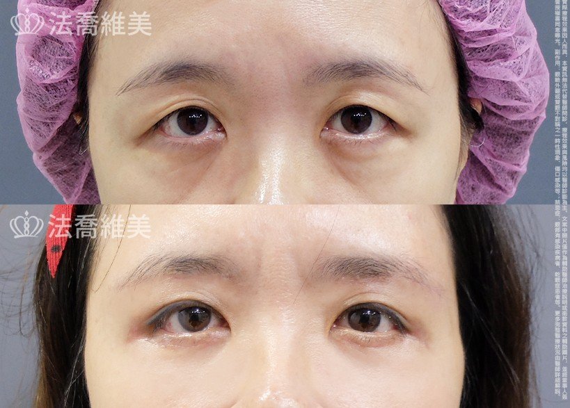 法喬維美醫美診所