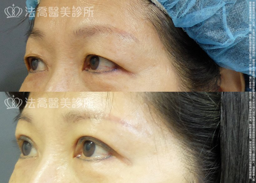 法喬醫美診所 邱浚彥醫師