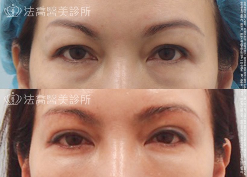 法喬醫美診所 邱浚彥醫師