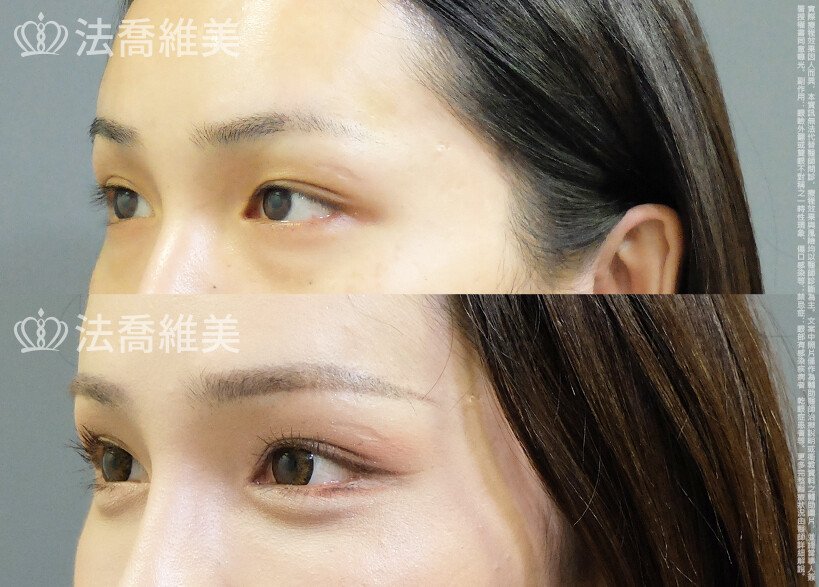 法喬維美醫美診所