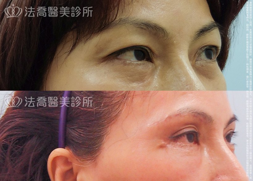 法喬醫美診所 邱浚彥醫師