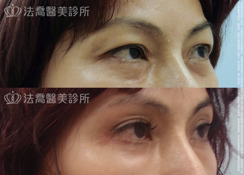 法喬醫美診所 邱浚彥醫師