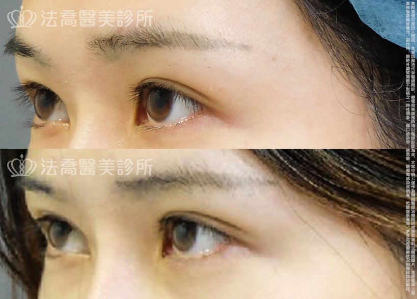 法喬醫美診所 邱浚彥醫師