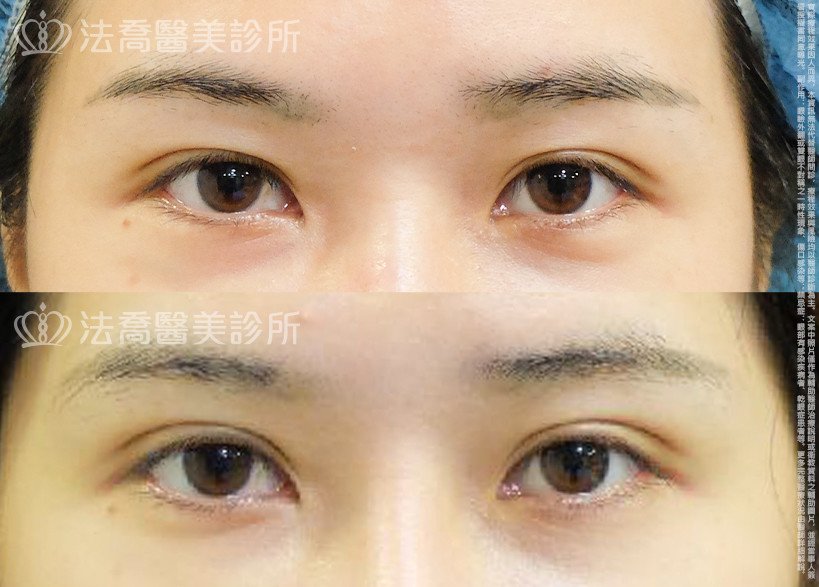 法喬醫美診所 邱浚彥醫師