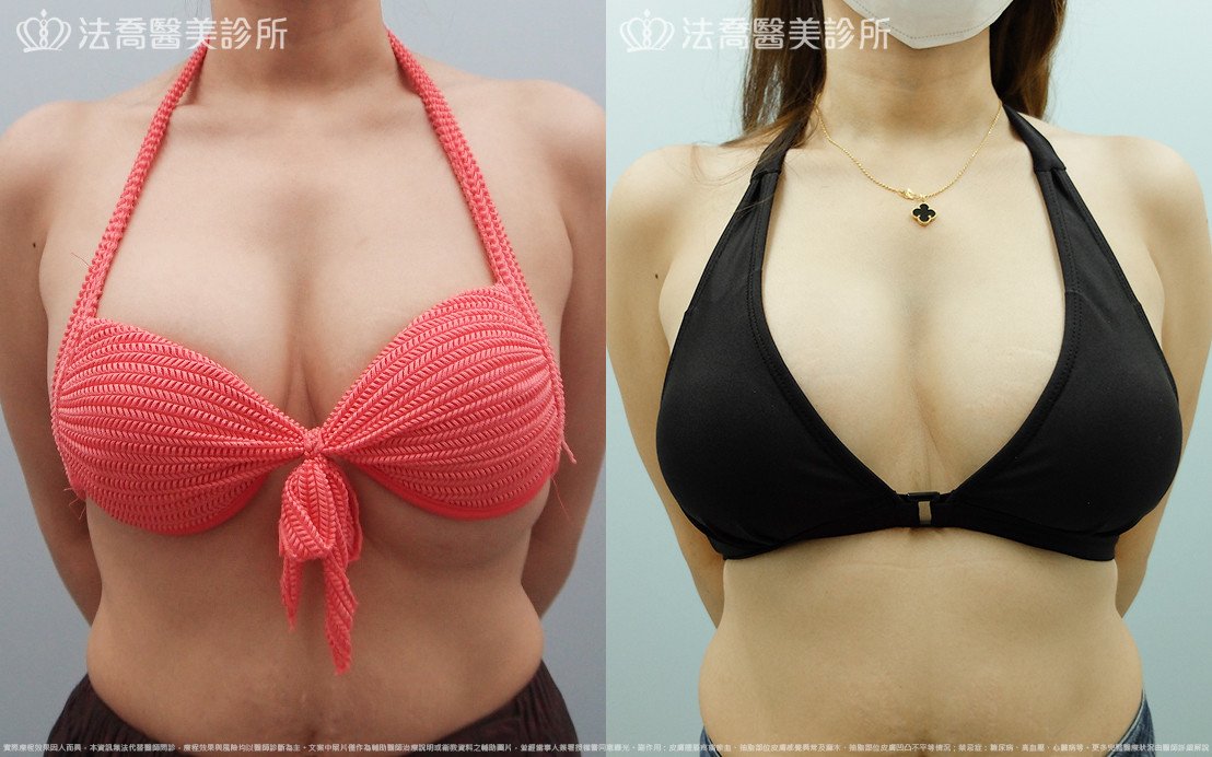 法喬醫美診所 邱浚彥醫師