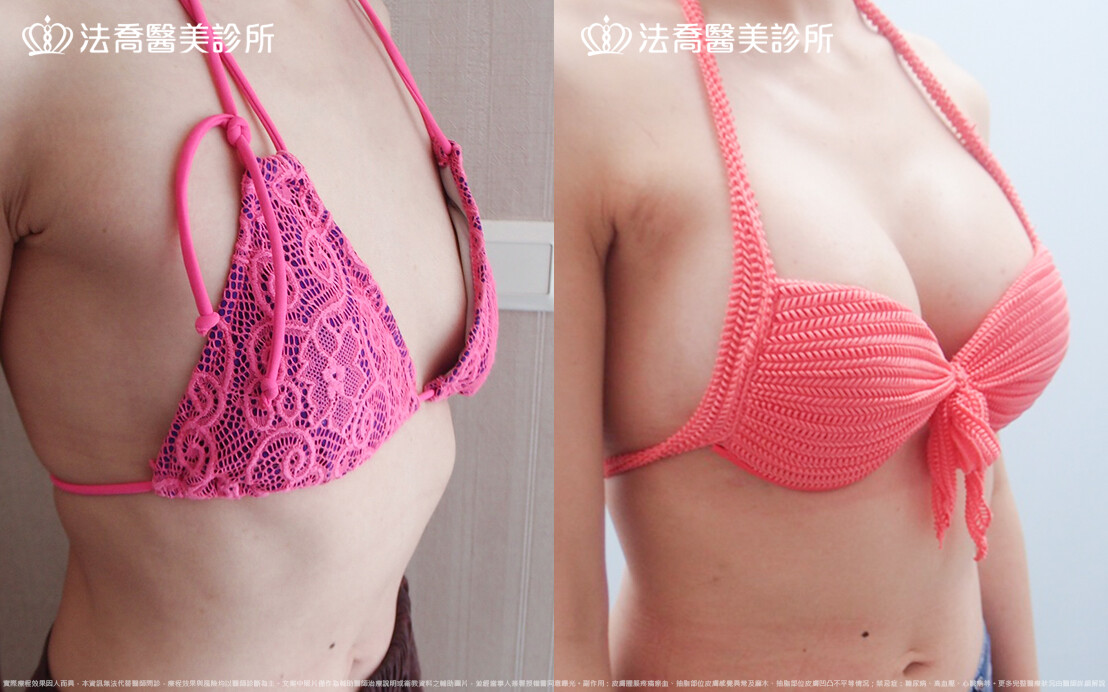 法喬醫美診所 邱浚彥醫師