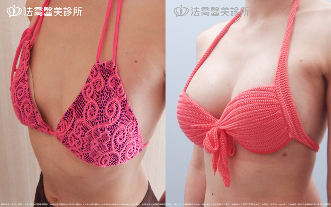 法喬醫美診所 邱浚彥醫師