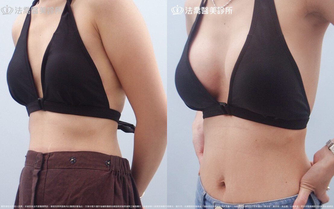 法喬醫美診所 邱浚彥醫師