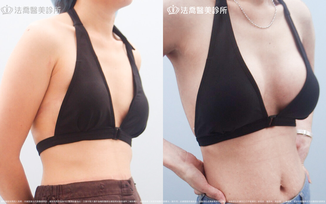 法喬醫美診所 邱浚彥醫師