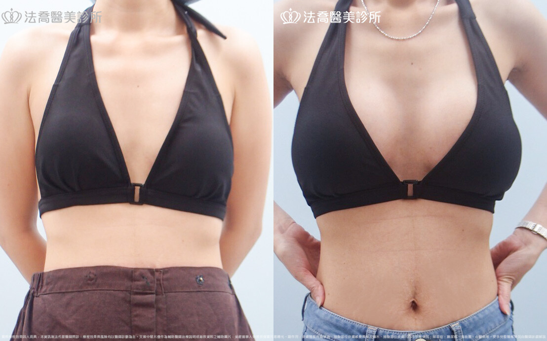 法喬醫美診所 邱浚彥醫師