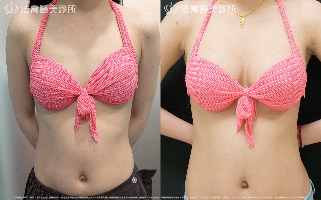 法喬醫美診所 邱浚彥醫師