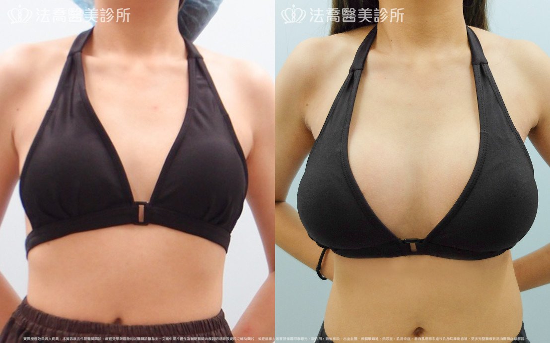 法喬醫美診所 邱浚彥醫師