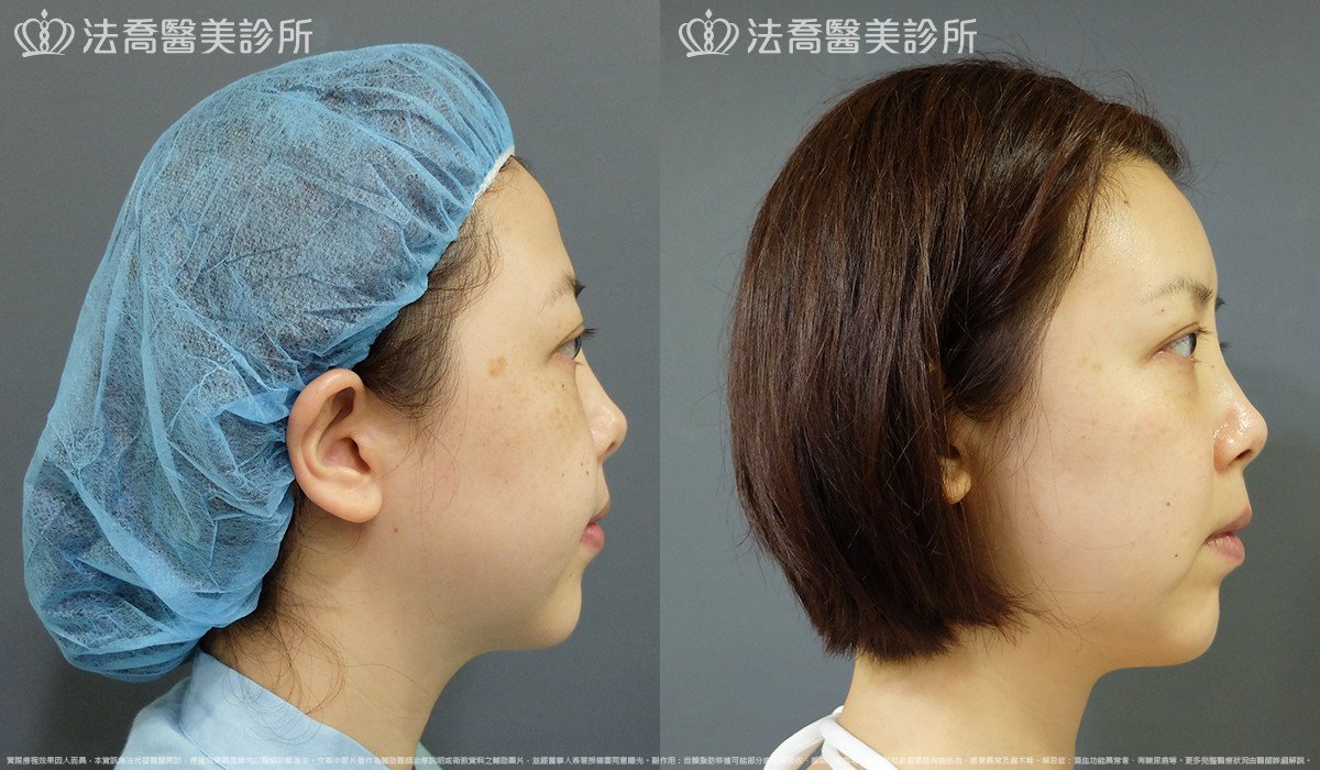 法喬醫美診所 邱浚彥醫師