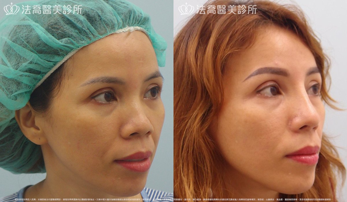 法喬醫美診所 邱浚彥醫師