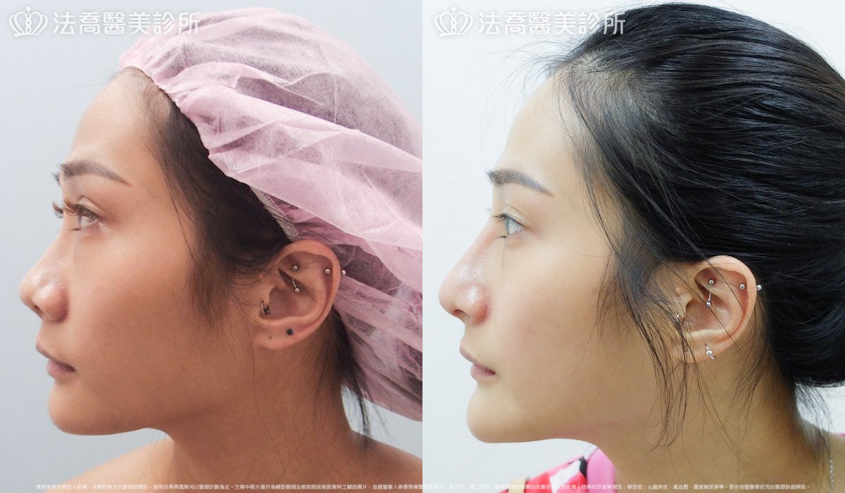 法喬醫美診所 邱浚彥醫師