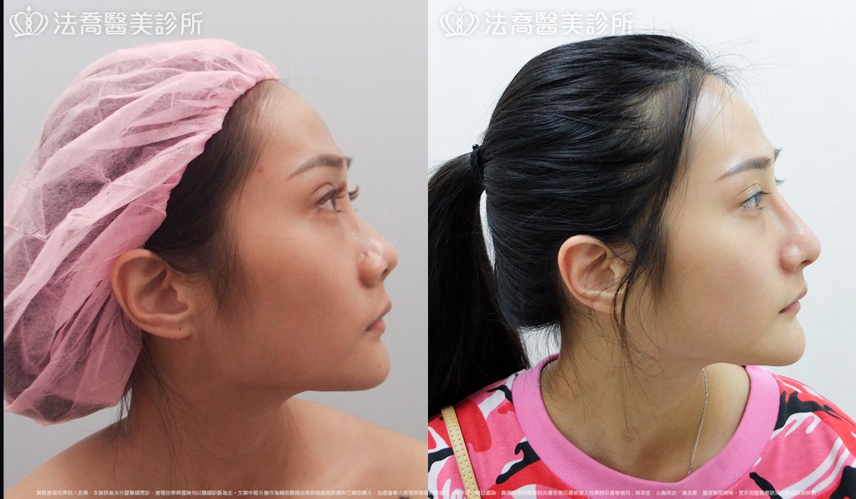 法喬醫美診所 邱浚彥醫師