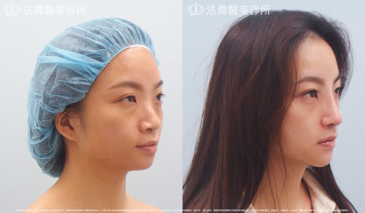 法喬醫美診所 邱浚彥醫師