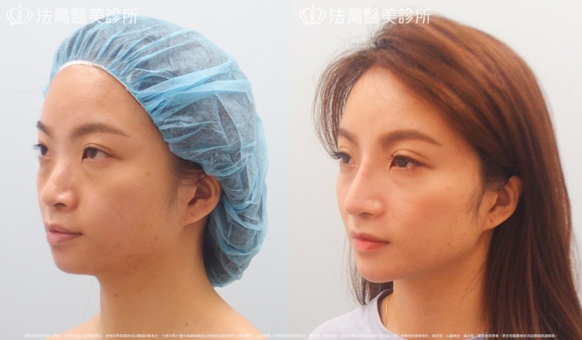 法喬醫美診所 邱浚彥醫師