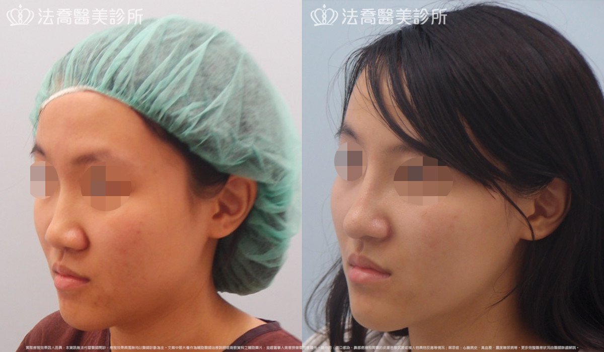 法喬醫美診所 邱浚彥醫師