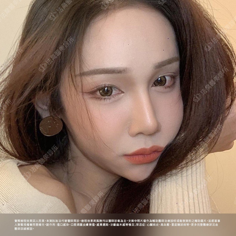 術後3個月生活照