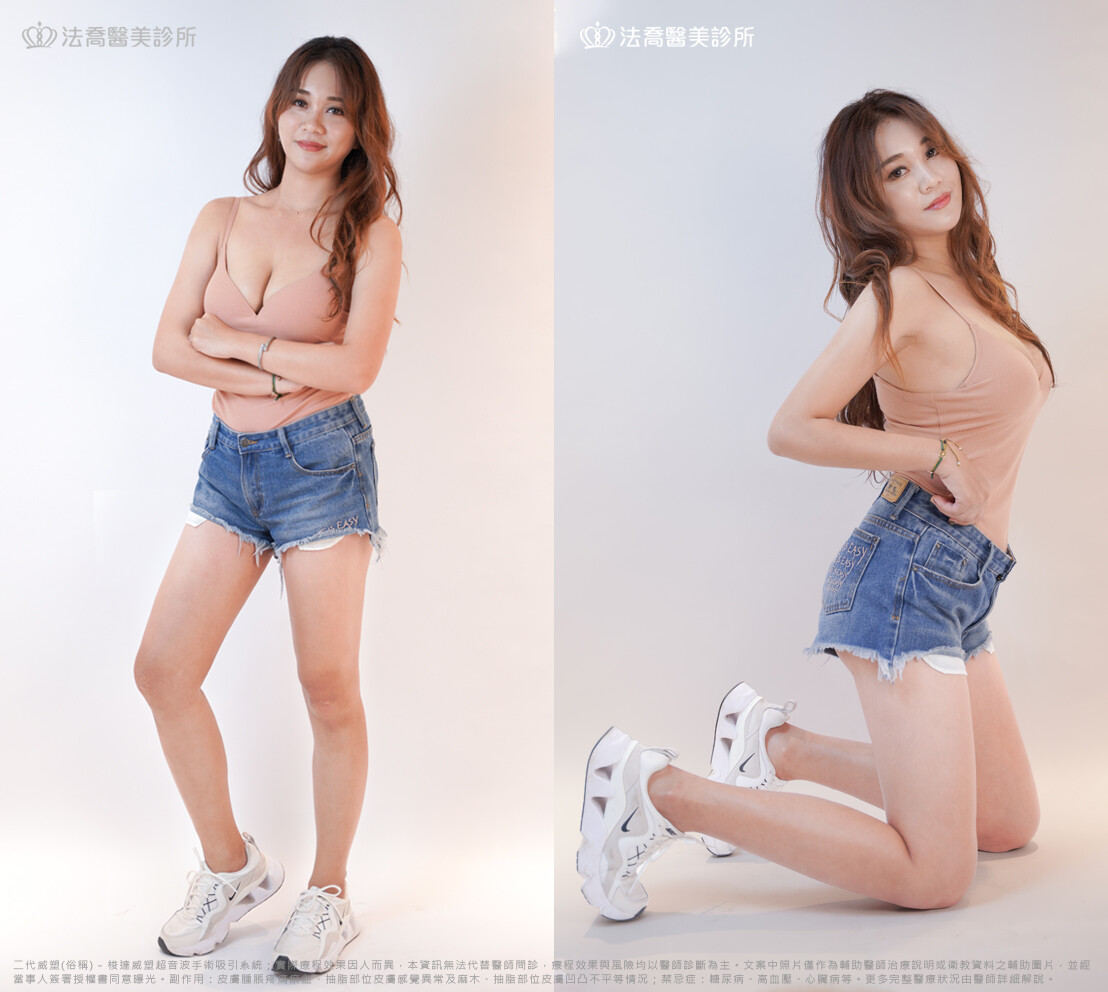 法喬醫美診所,邱浚彥,威塑抽脂