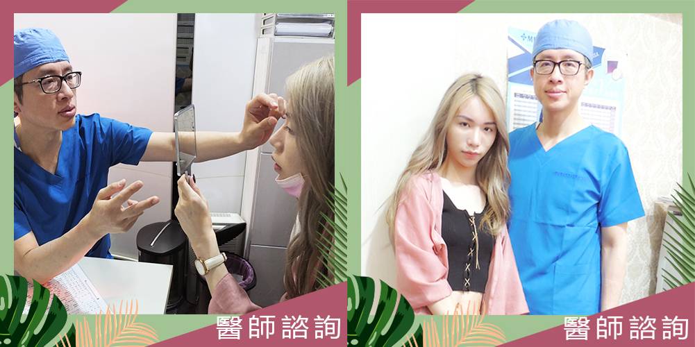 法喬醫美診所-割雙眼皮併眼瞼肌提拉術+開眼頭+開眼尾+自體脂肪豐全臉