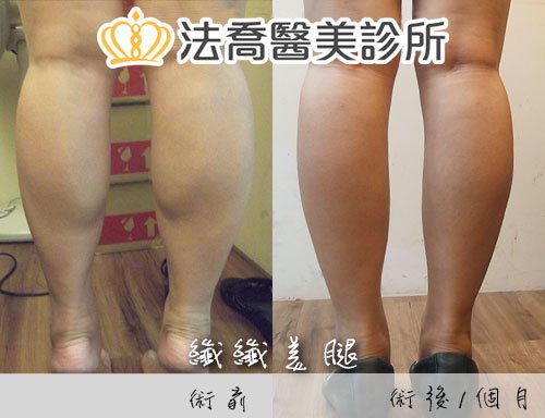法喬醫美診所 邱浚彥醫師