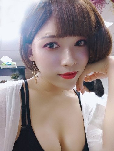 法喬邱浚彥隆乳術後12個月案例照