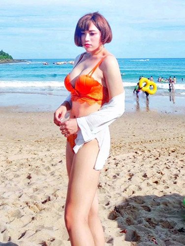 法喬邱浚彥隆乳術後12個月案例照