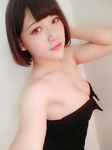 法喬邱浚彥隆乳術後90天案例照