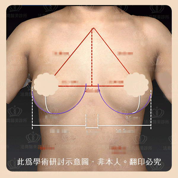 Vectra 微擬3D影像模擬系統