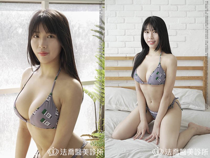 法喬醫美診所,邱浚彥,魔滴隆乳,隆乳推薦
